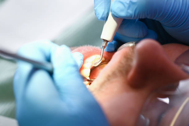 Best Emergency Dental Care for Sports Injuries in Canyon Creek, WA